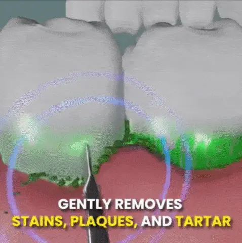 gif of Ortho Rinse Pick cleaning plaque